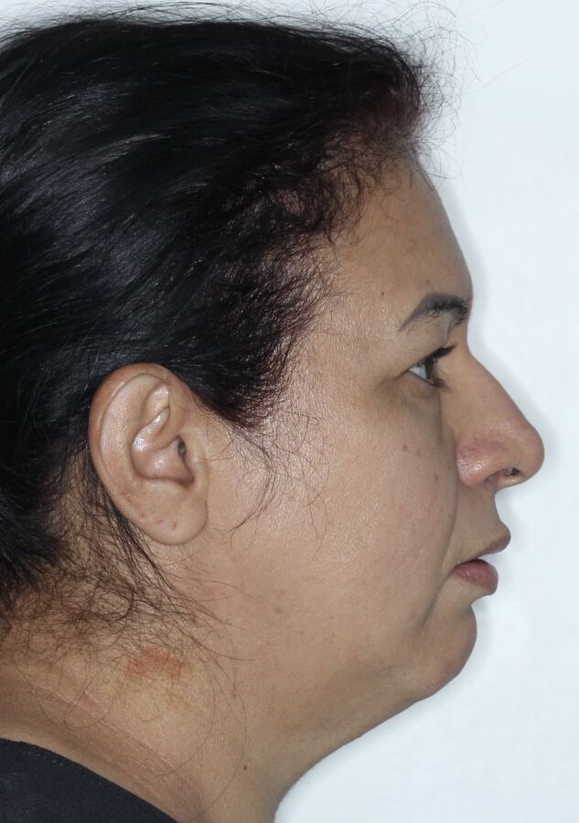 Paciente 02 antes